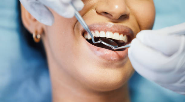 Best Teeth Whitening  in Alamosa, CO